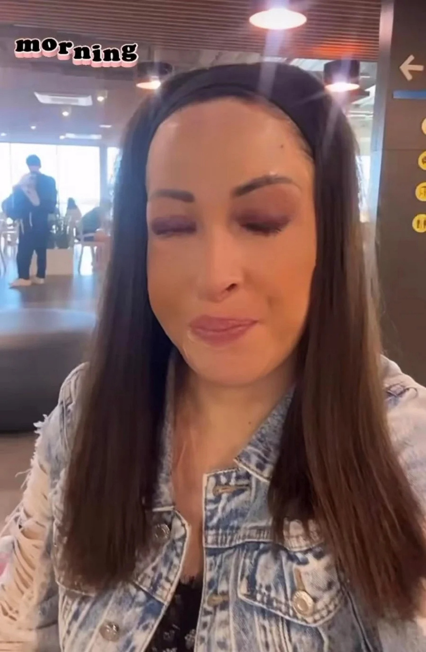 4 χρόνια & 20 επεμβάσεις μετά: Η Ιωάννα Παλιοσπύρου στο απόλυτο κοντινό, δείχνει το πρόσωπό της σήμερα & αποθεώνεται