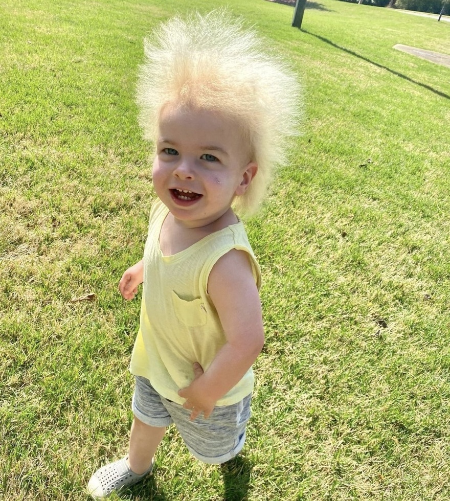 Το αγοράκι με το πιο “γλυκό” σύνδρομο έγινε 6 ετών και έγινε η πρώτη φίρμα στο Instagram