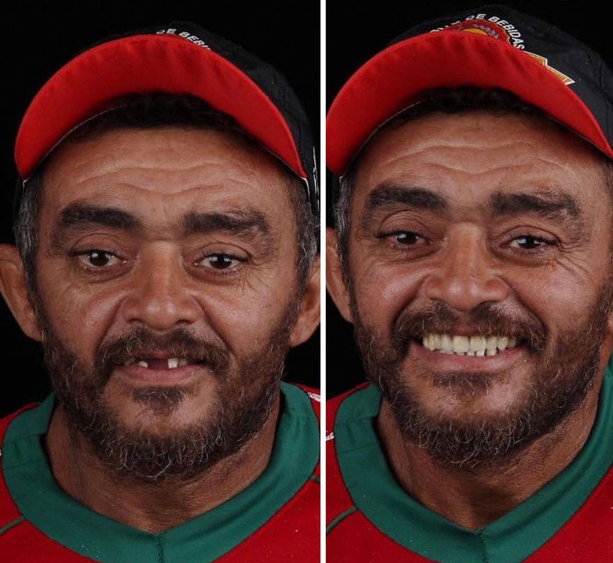 Οδοντίατρος φτιάχνει δωρεάν τα δόντια φτωχών ανθρώπων και μοιράζει χαμόγελα ευτυχίας