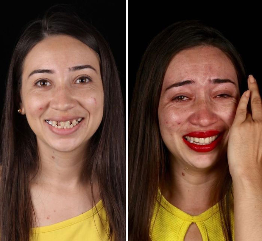 Οδοντίατρος φτιάχνει δωρεάν τα δόντια φτωχών ανθρώπων και μοιράζει χαμόγελα ευτυχίας