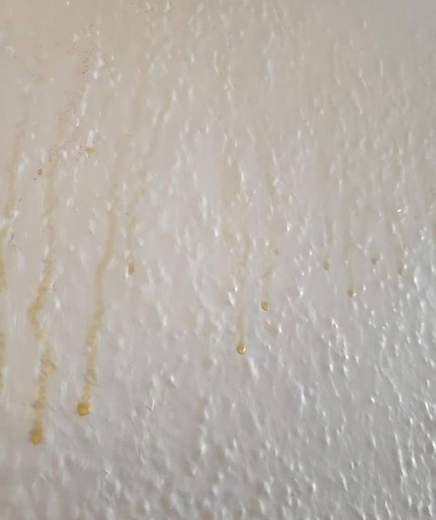 Yellow Stuff Starts Dripping Down Your Bathroom Walls?