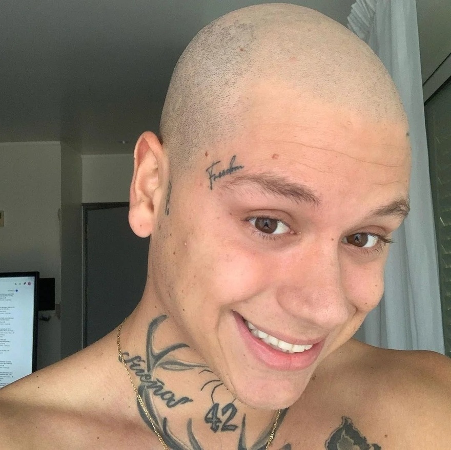 Mike: «Σήμερα κλείνω έναν χρόνο καθαρός από τον καρκίνο»