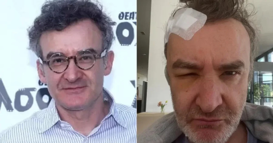 Νίκος Ορφανός: «Είχα όγκο στο κεφάλι» – Τι είναι το κρανιοφαρυγγίωμα για το οποίο έκανε επέμβαση στη Γερμανία