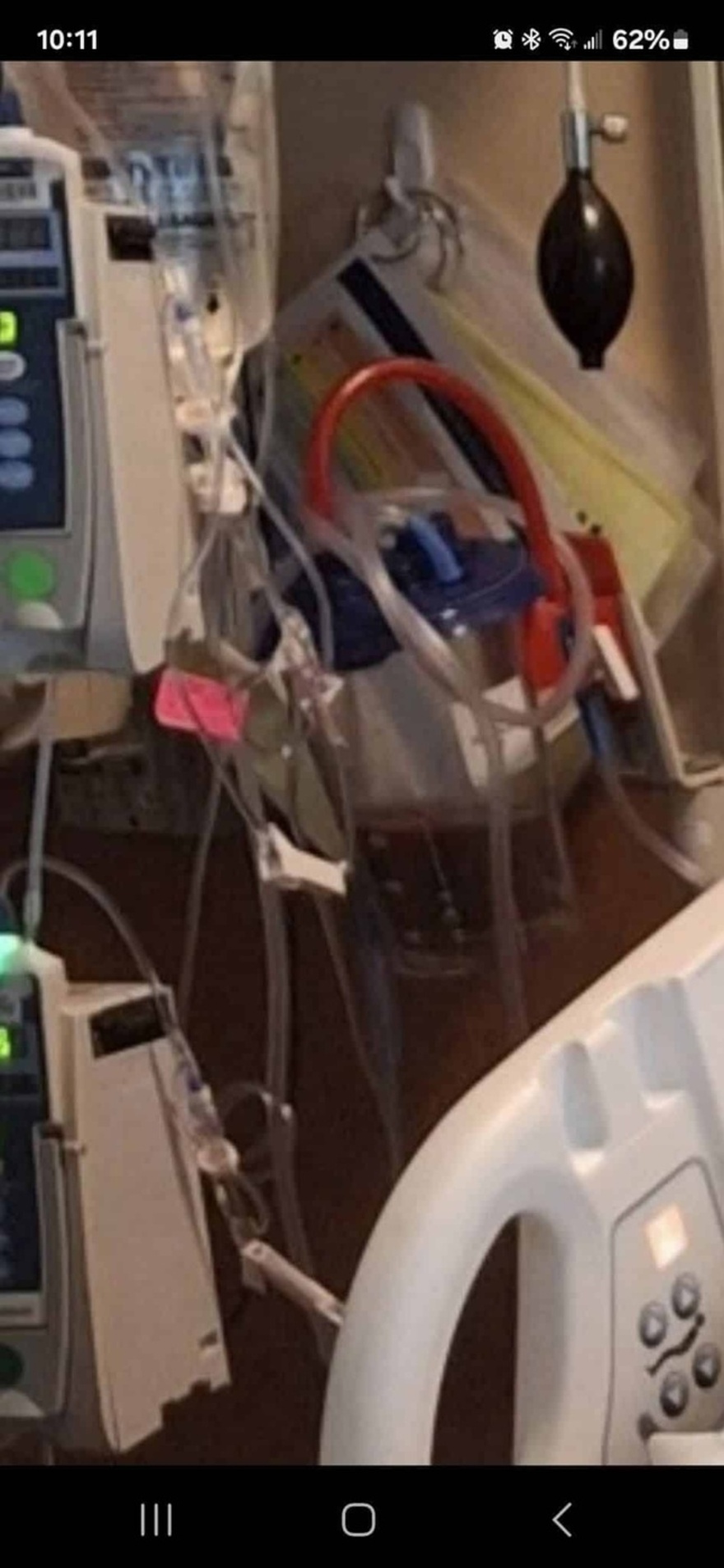 Έβγαλαν δύο λίτρα μαύρου υγρού από τους πνεύμονες 32χρονης που έκανε ηλεκτρονικό τσιγάρο