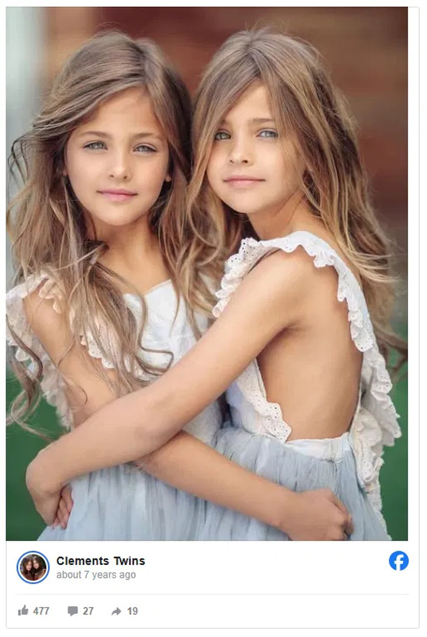 «Τα πιο όμορφα δίδυμα στον κόσμο» είναι τώρα εντυπωσιακές νεαρές έφηβες