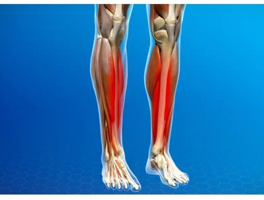 Η βιταμίνη που χρειάζεστε αν σας πονάνε τα πόδια σας και τα κόκαλα σας