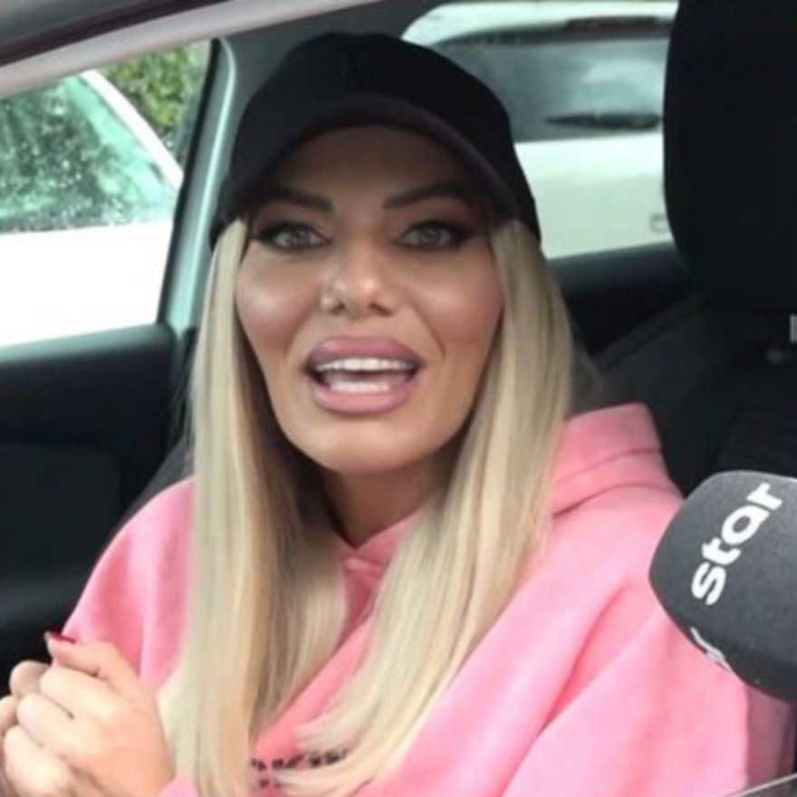 Αγνώριστη πασίγνωστη Ελληνίδα παρουσιάστρια – Έγινε άλλος… άνθρωπος από τις επεμβάσεις