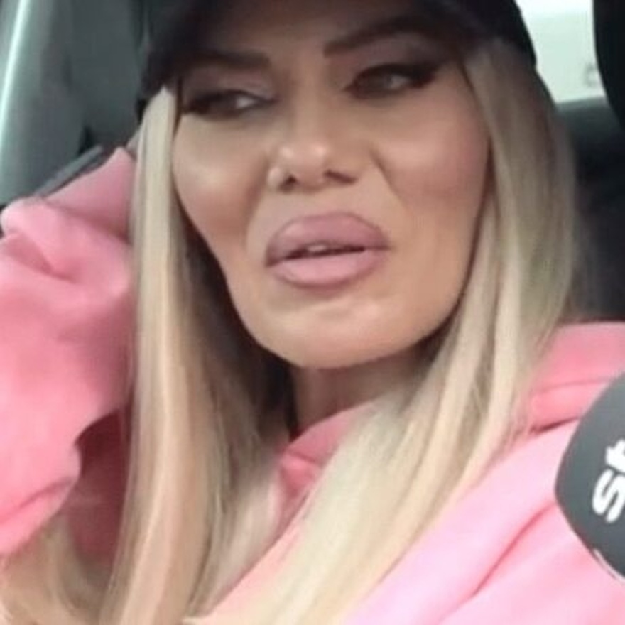 Αγνώριστη πασίγνωστη Ελληνίδα παρουσιάστρια – Έγινε άλλος… άνθρωπος από τις επεμβάσεις