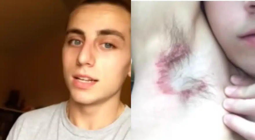 Εκεί που έκανε μπάνιο, ένιωσε κάτι να τον καίει κάτω από τη μασχάλη. Δεν ήταν όμως το σαπούνι…