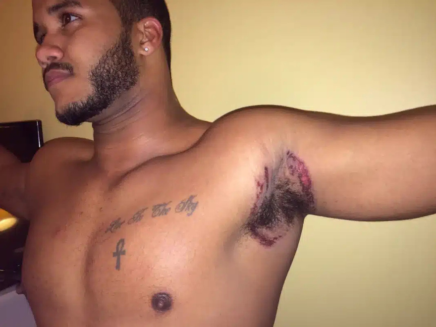 Εκεί που έκανε μπάνιο, ένιωσε κάτι να τον καίει κάτω από τη μασχάλη. Δεν ήταν όμως το σαπούνι…