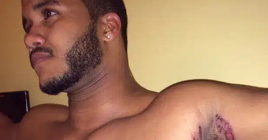 Εκεί που έκανε μπάνιο, ένιωσε κάτι να τον καίει κάτω από τη μασχάλη. Δεν ήταν όμως το σαπούνι…