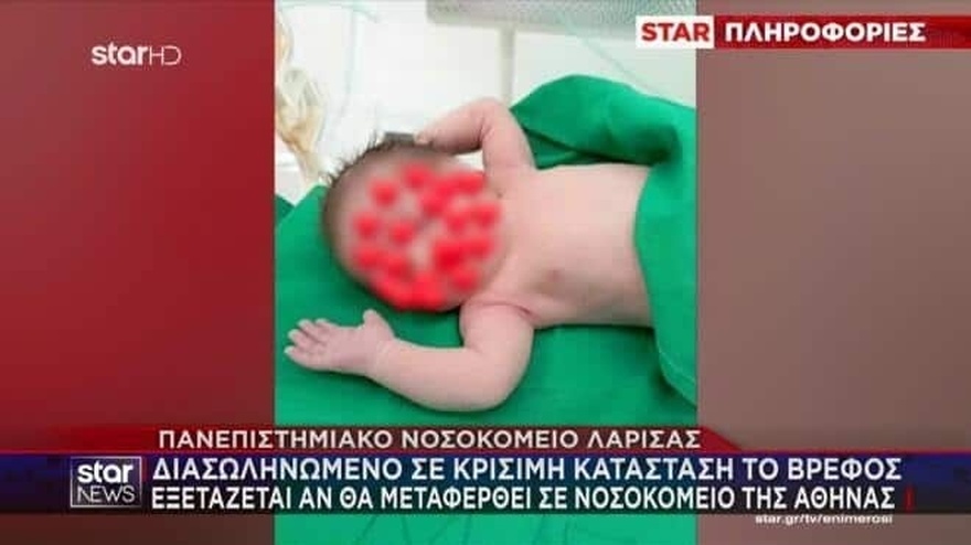 Χαμόγελα για το 18 μηνών βρέφος από την Καρδίτσα με τα εγκαύματα από καυτό λάδι – «Είστε φύλακες άγγελοι» λένε οι γονείς στο νοσηλευτικό προσωπικό