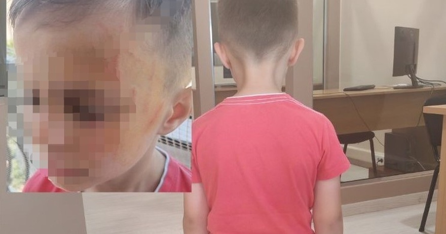 Tpόμος για μικρούλη: Έδειραν 5χρονο σε… νηπιαγωγείο του Αγρινίου