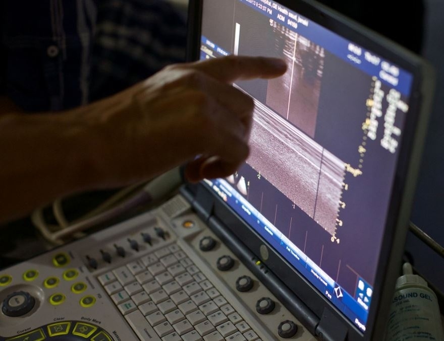 Aδιανόητο Συμβάν : Ζευγάρι με δίδυμα περιμένει και πάλι παιδί, αλλά ο γιατρός δείχνει το υπερηχογράφημα και ο σύζυγος αμέσως λιποθυμά