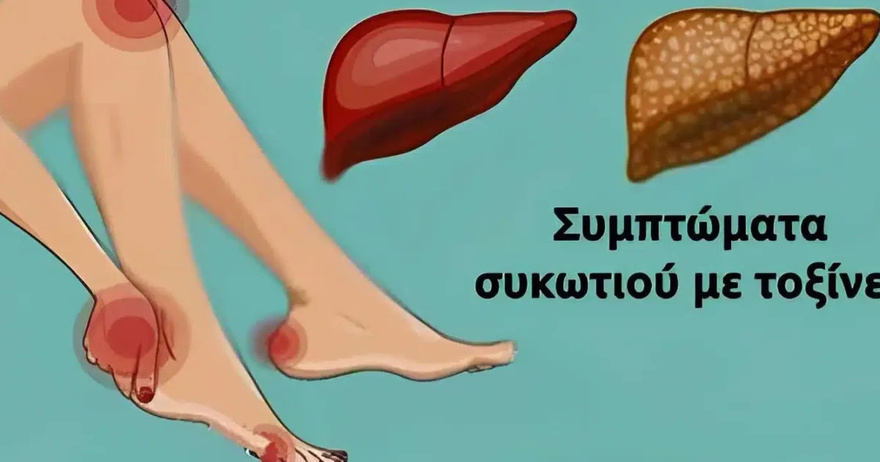 11 Σημάδια ότι το συκώτι σας δεν λειτουργεί σωστά και τοξίνες χτίζονται στο σώμα σας