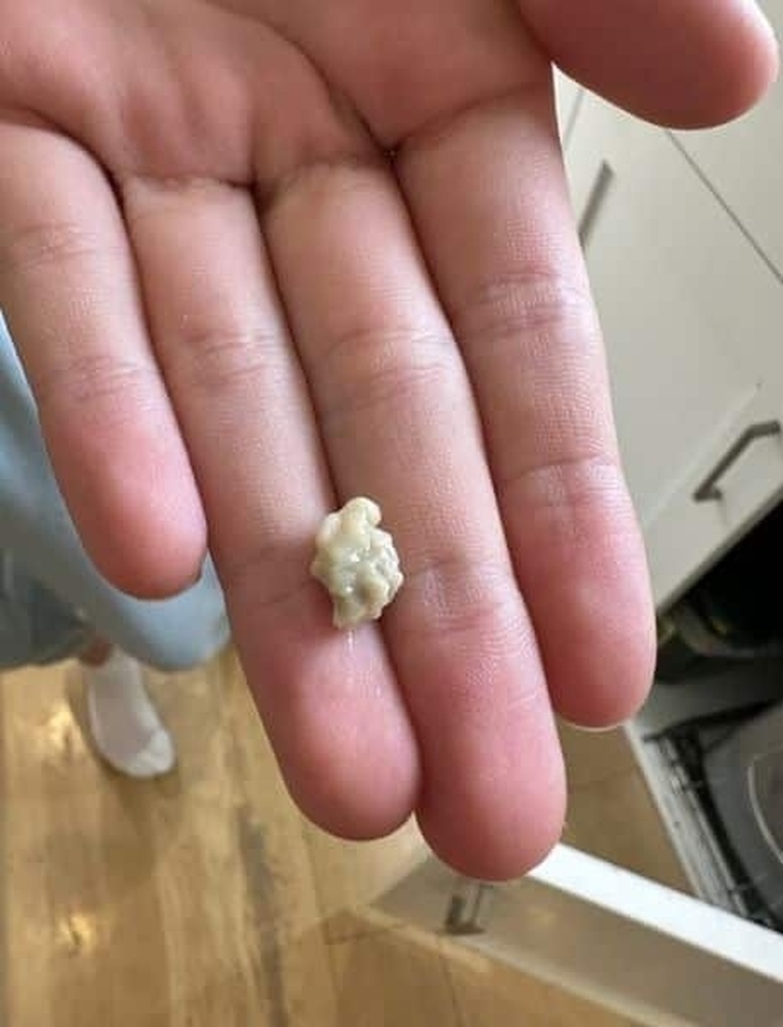 Να τι πρέπει να γνωρίζετε για αυτές τις πέτρες – Που εμφανίζονται