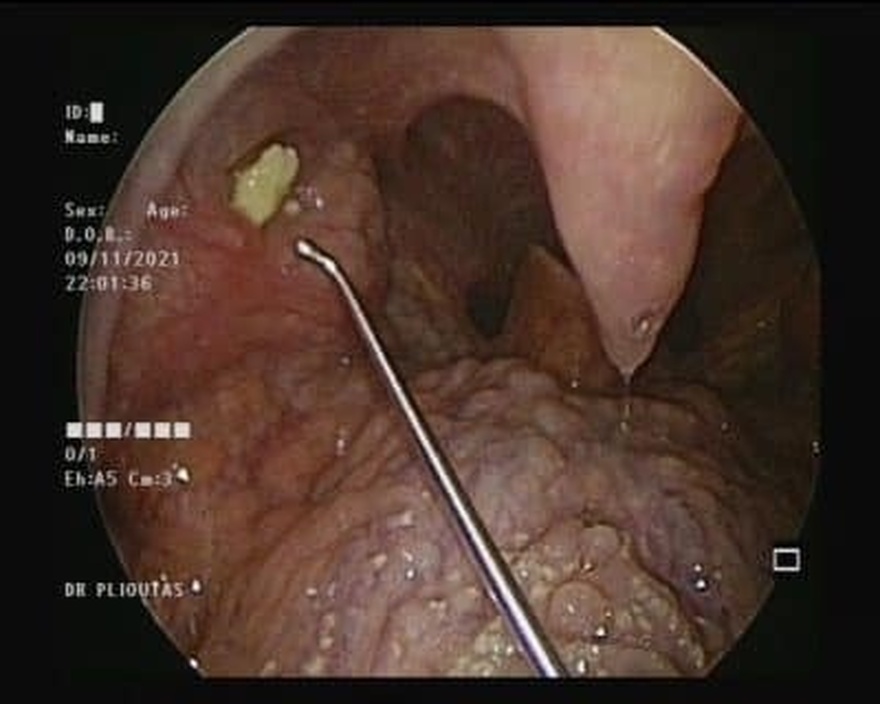 Να τι πρέπει να γνωρίζετε για αυτές τις πέτρες – Που εμφανίζονται
