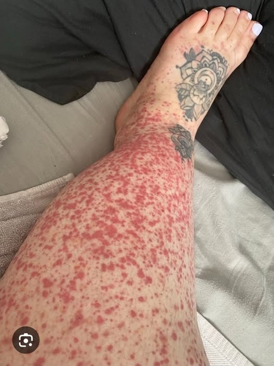 Αυτές είναι οι συνέπειες του να κοιμάσαι με…