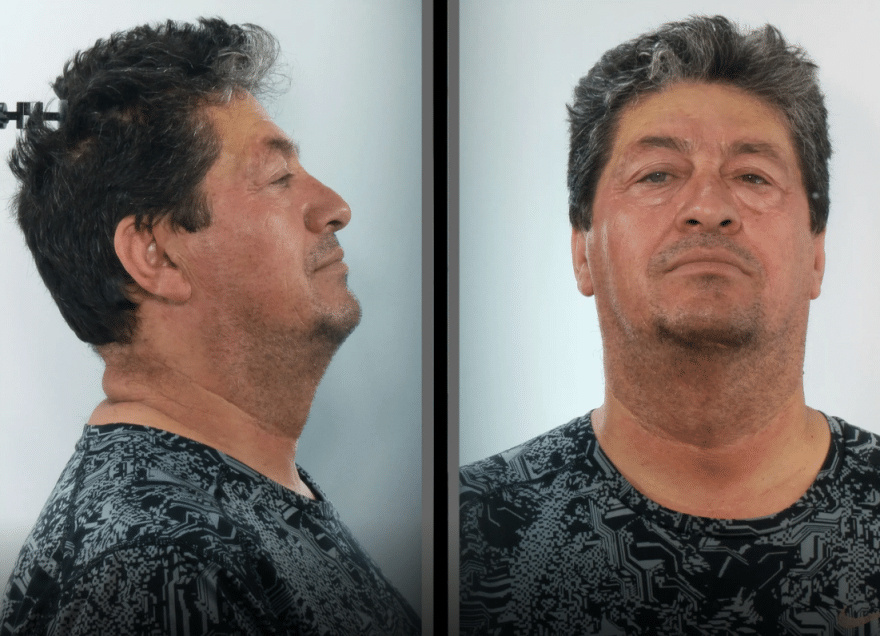 Αυτός είναι ο 63χρονος γυμνασιάρχης που προφυλακίστηκε για βıασμό μαθήτριας