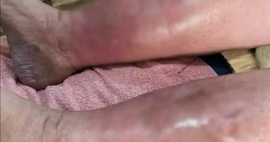 Ξεκάθαρα συμπτώματα ότι αυτό είναι…