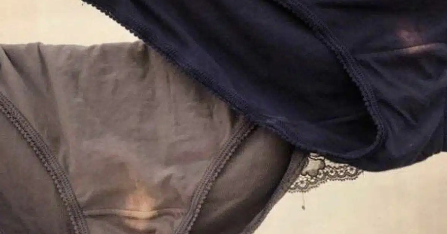 Όλα όσα πρέπει να ξέρετε για το υγρό που βγαίνει από
