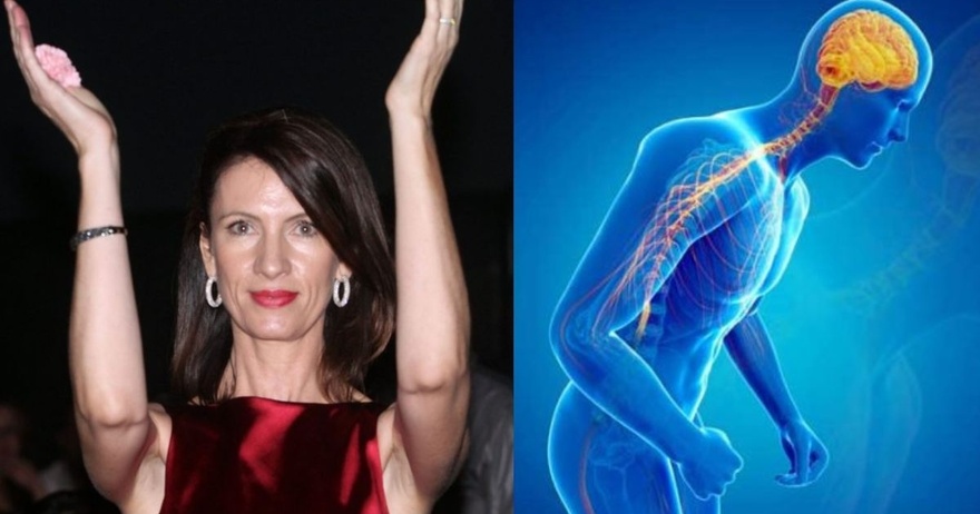 Κίλι Σφακιανάκη: Τι είναι η Νόσος Πάρκινσον από την οποία πέθανε και ποια τα συμπτώματα