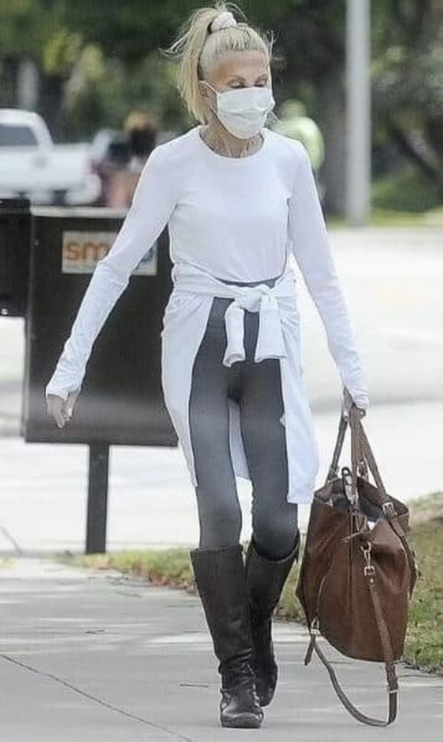 Παραμορφώθηκε από τις πλαστικές, μοιάζει με «μoυμια»: Πασίγνωστη σταρ έγινε αγνώριστη από τη ματαιοδοξία