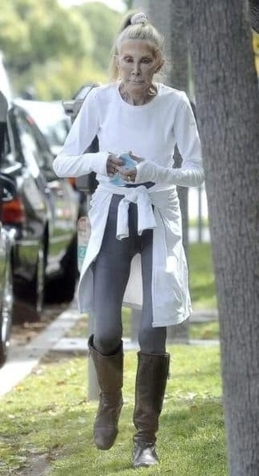 Παραμορφώθηκε από τις πλαστικές, μοιάζει με «μoυμια»: Πασίγνωστη σταρ έγινε αγνώριστη από τη ματαιοδοξία